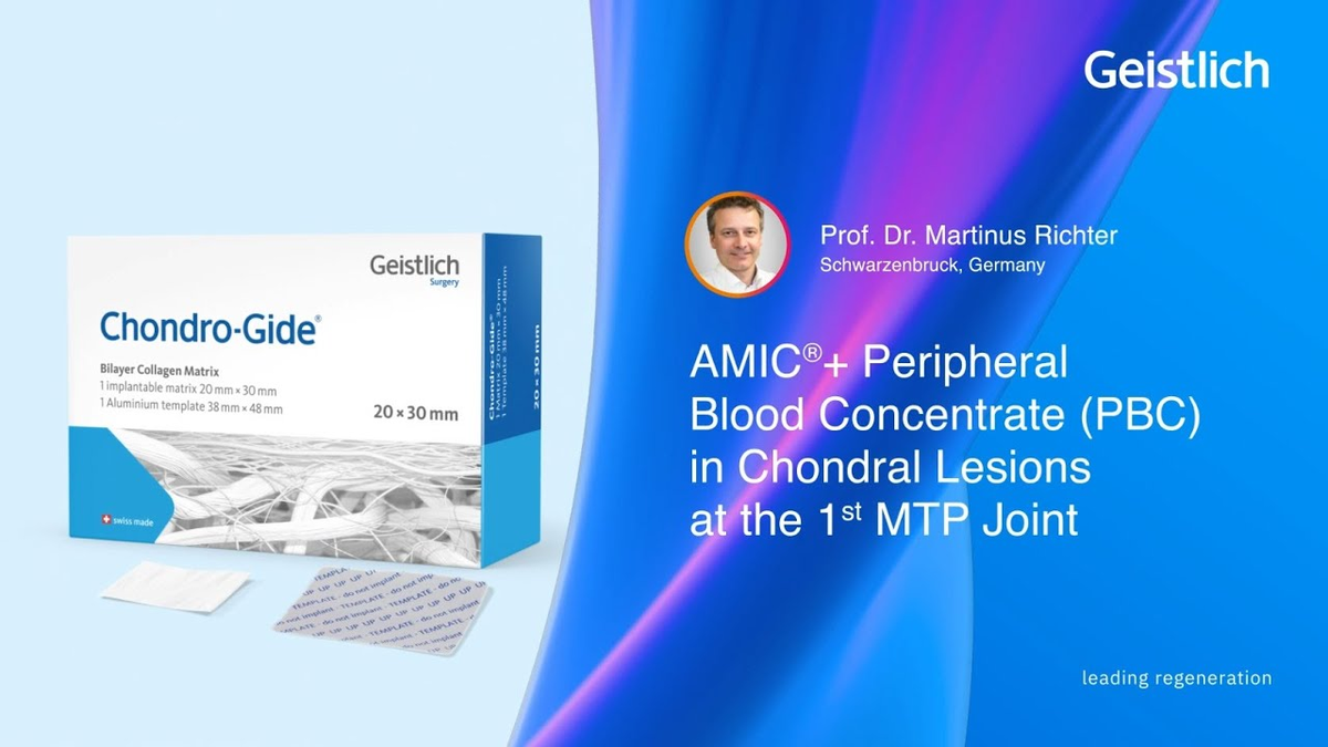 AMIC®+ PBC Operationstechnik von Prof. Dr. Martinus Richter
