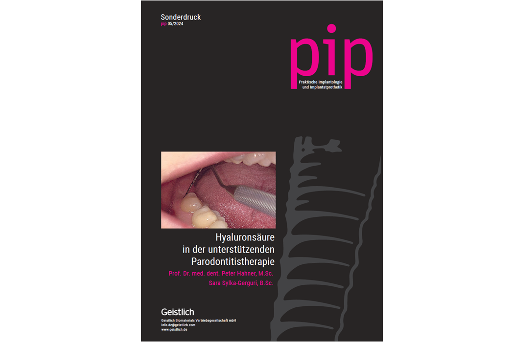 Sonderdruck PIP - Hyaluronsäure in der unterstützenden Parodontitistherapie